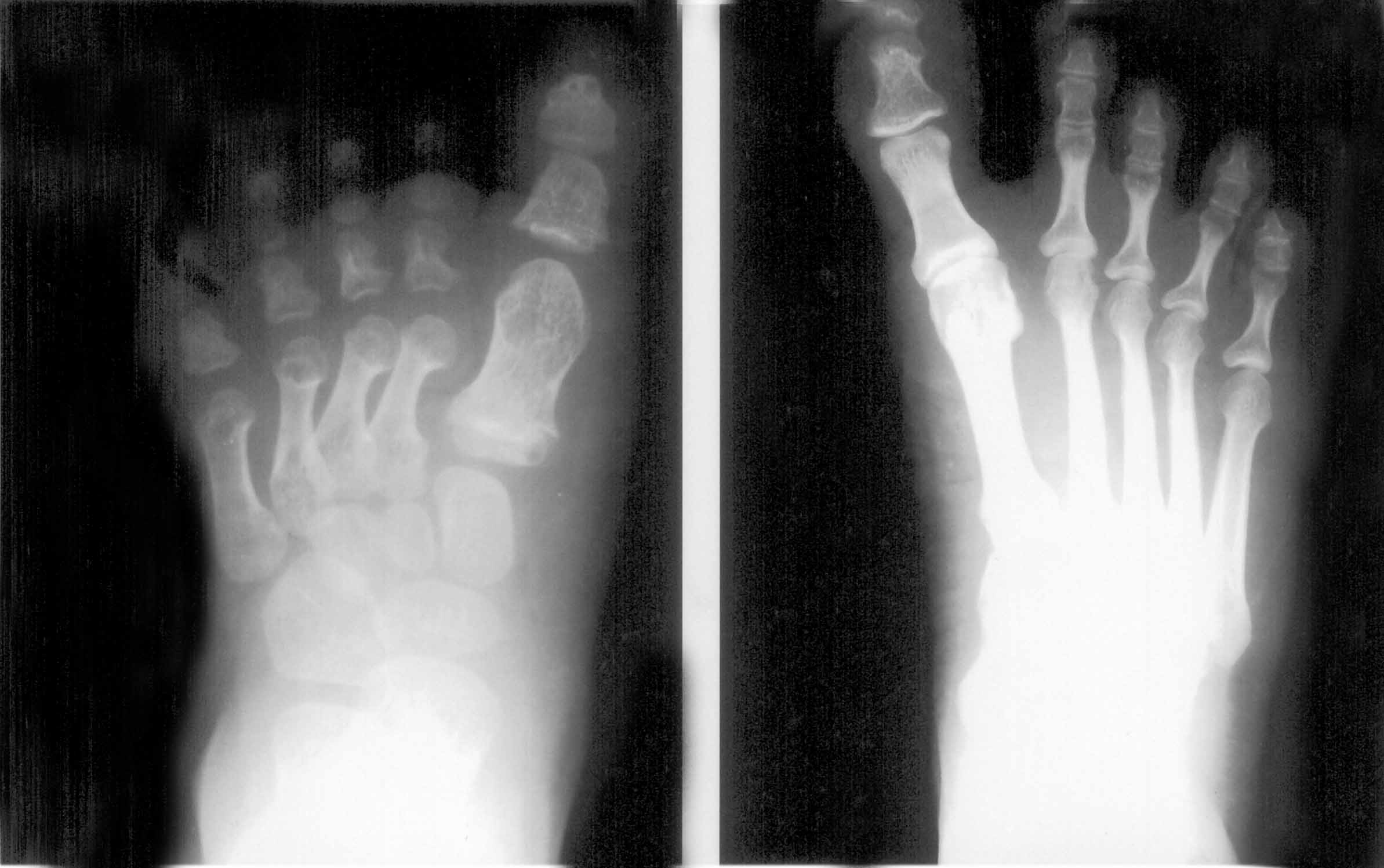 x ray feet