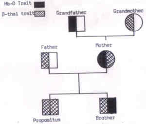 Fig. 12. A classical pedigree chart of a beta-thalassemia child (propositus). 